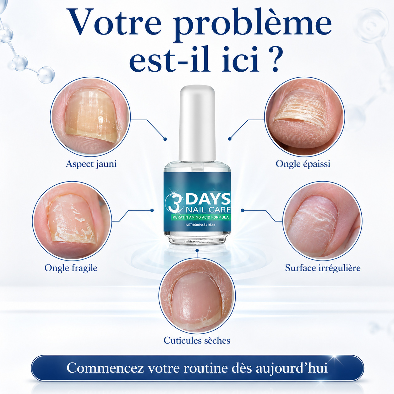 💅 Dites STOP aux ongles cassants !