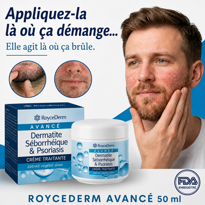 RoyceDerm - Seborrheic Dermatitis & Psoriasis Cream