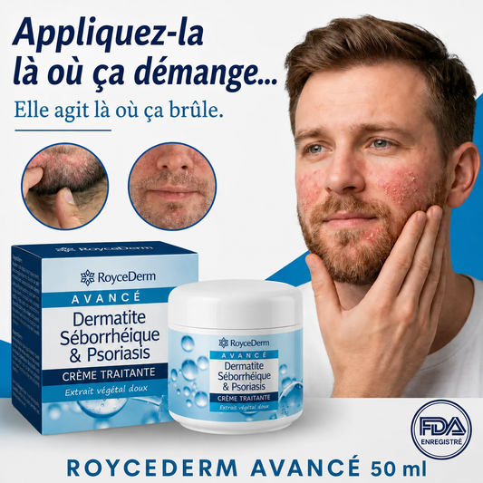 RoyceDerm - Seborrheic Dermatitis & Psoriasis Cream