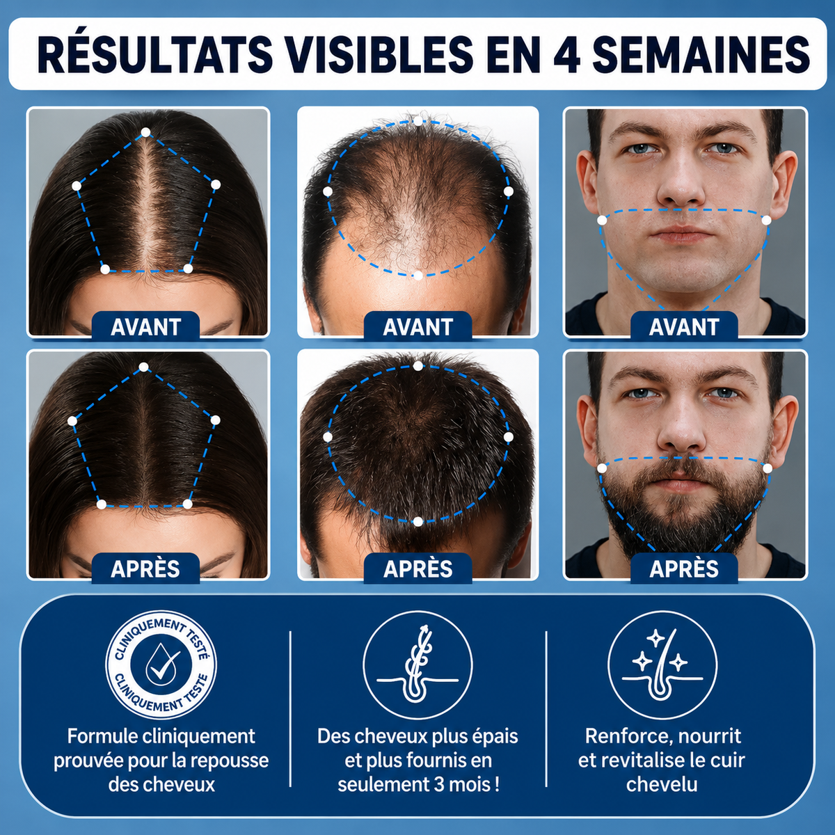 APARTHY — Sérum Roll-On pour la Densité des Cheveux