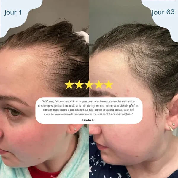 Sérum roll-on pour la croissance des cheveux