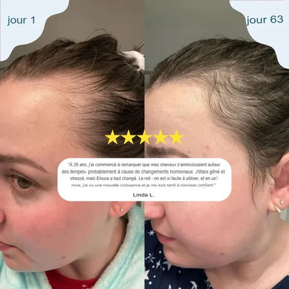Sérum roll-on pour la croissance des cheveux