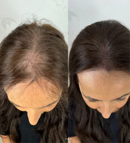 Sérum roll-on pour la croissance des cheveux